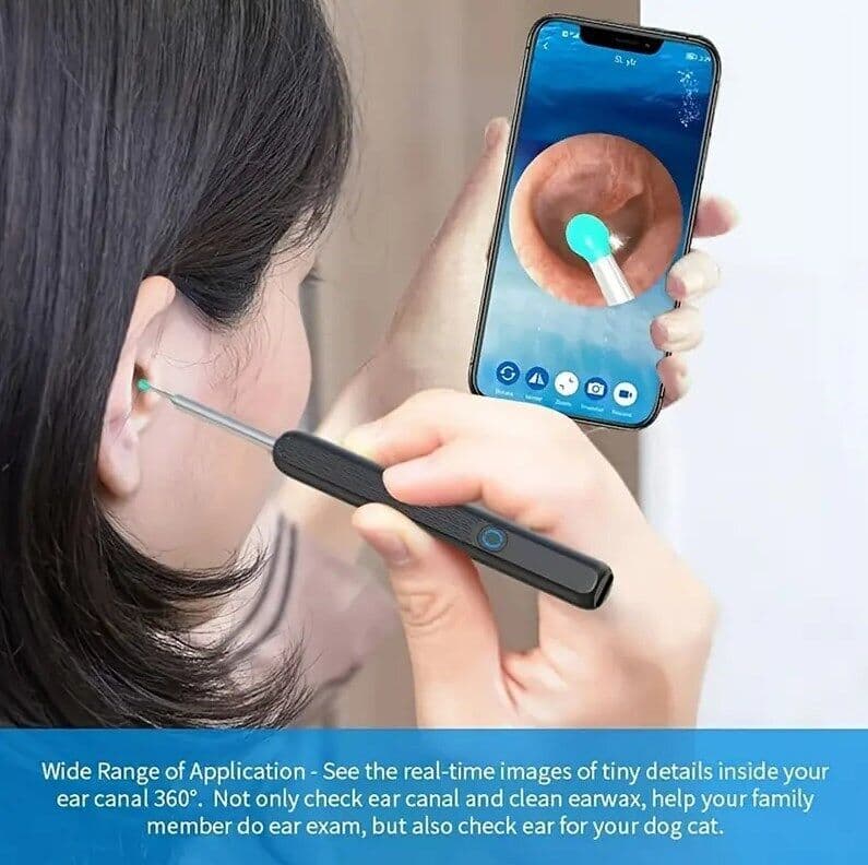 Wireless Ear Wax Cleaning Tool with Built-In Camera - image 8