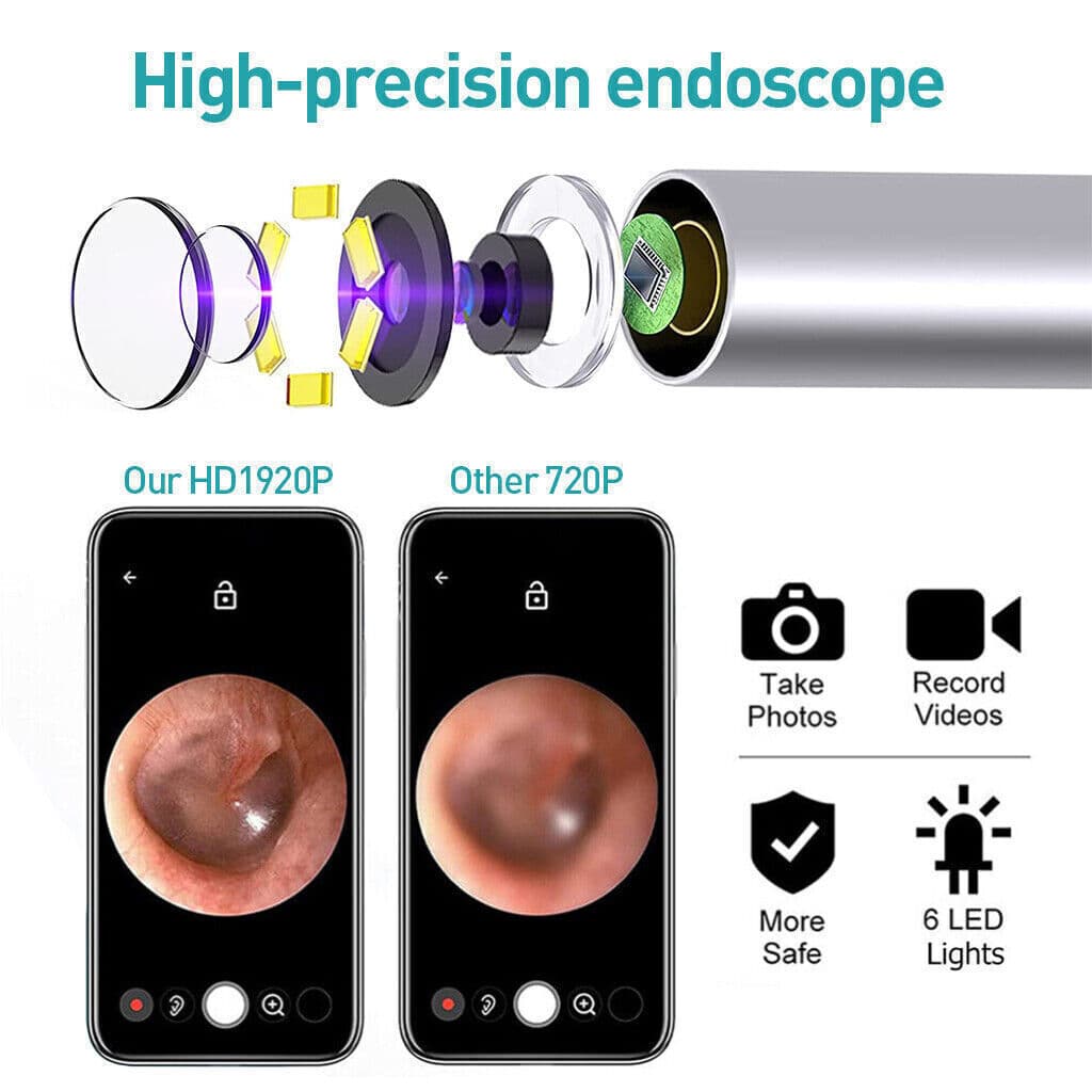 Wireless Ear Wax Cleaning Tool with Built-In Camera - image 6