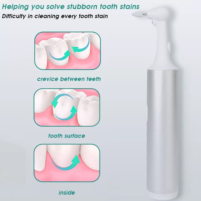 Electric Tooth Polisher for a Brighter, Whiter Smile - image 2
