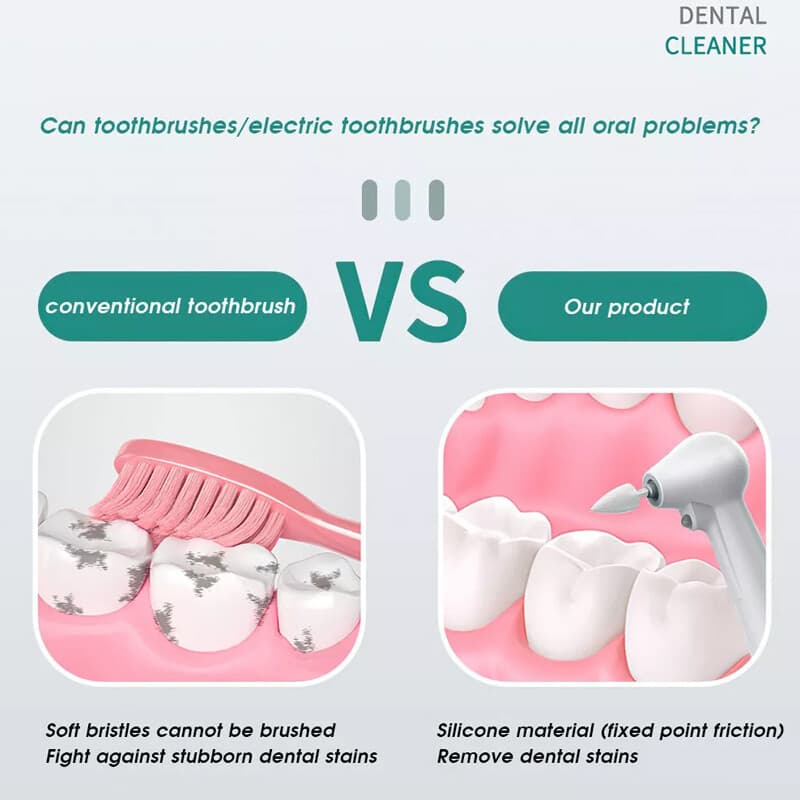 Electric Tooth Polisher for a Brighter, Whiter Smile - image 5