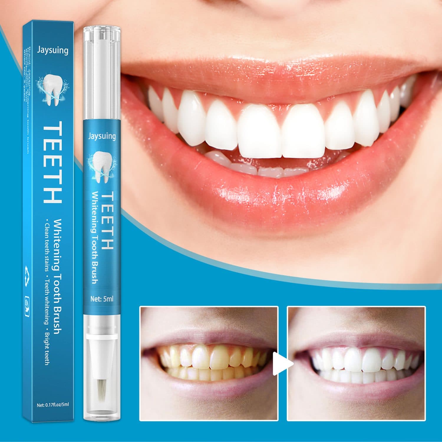 Tooth Whitening Pen - image 1